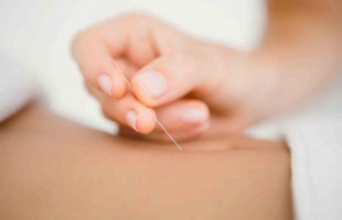 Acupunctuur helpt bij menstruatieklachten