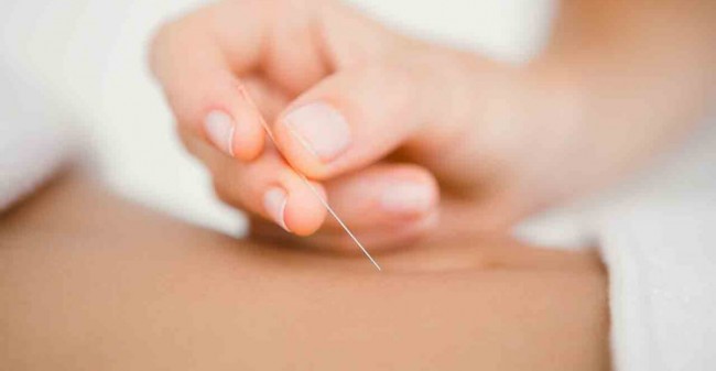Acupunctuur helpt bij menstruatieklachten