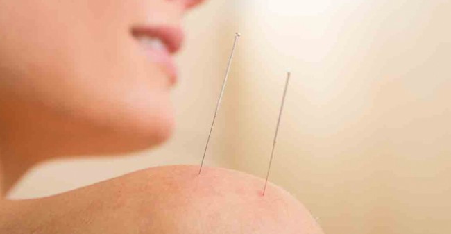 Vermoeidheid en acupunctuur
