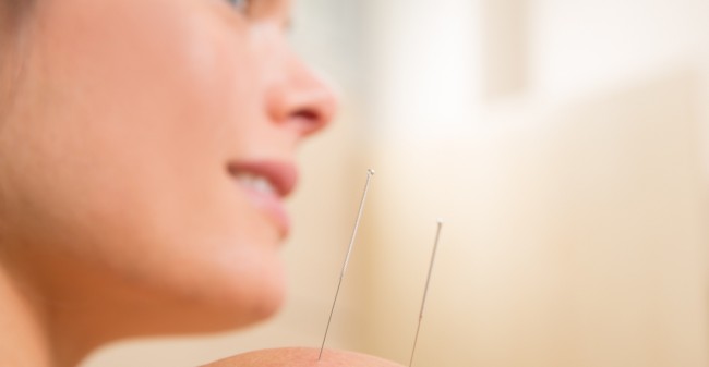 Hervind de balans met acupunctuur