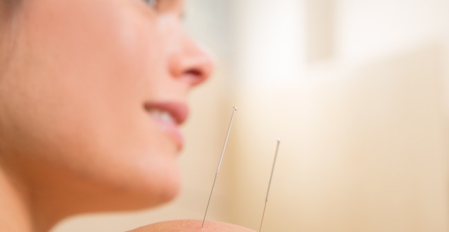 Hoofdpijn, migraine en acupunctuur