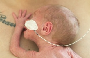 Zorg voor te vroeg geboren kinderen
