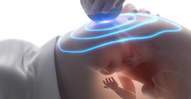 Maak nu alvast kennis met jullie baby!