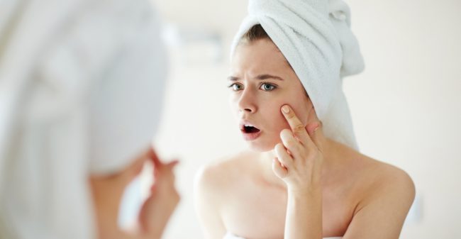 Acne? Weg ermee!