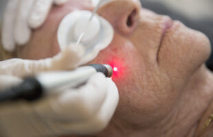 Een huidtherapeut helpt je huid vooruit